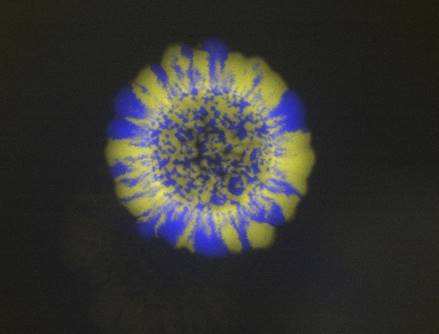 Sul Informação - Cientistas descobrem novo mecanismo para combater bactérias multirresistentes