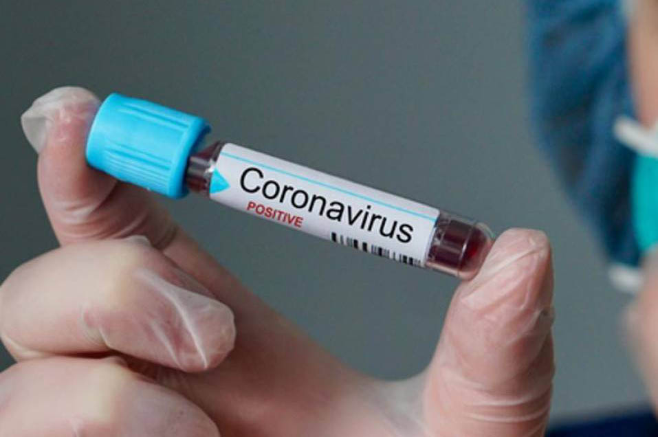 Sul Informação - Covid-19: Portugal fez mais de 370 mil testes à Covid-19 desde 1 de Março