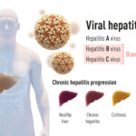 Sul Informação - Prémio Nobel da Medicina atribuído a 3 cientistas pela descoberta do vírus da Hepatite C