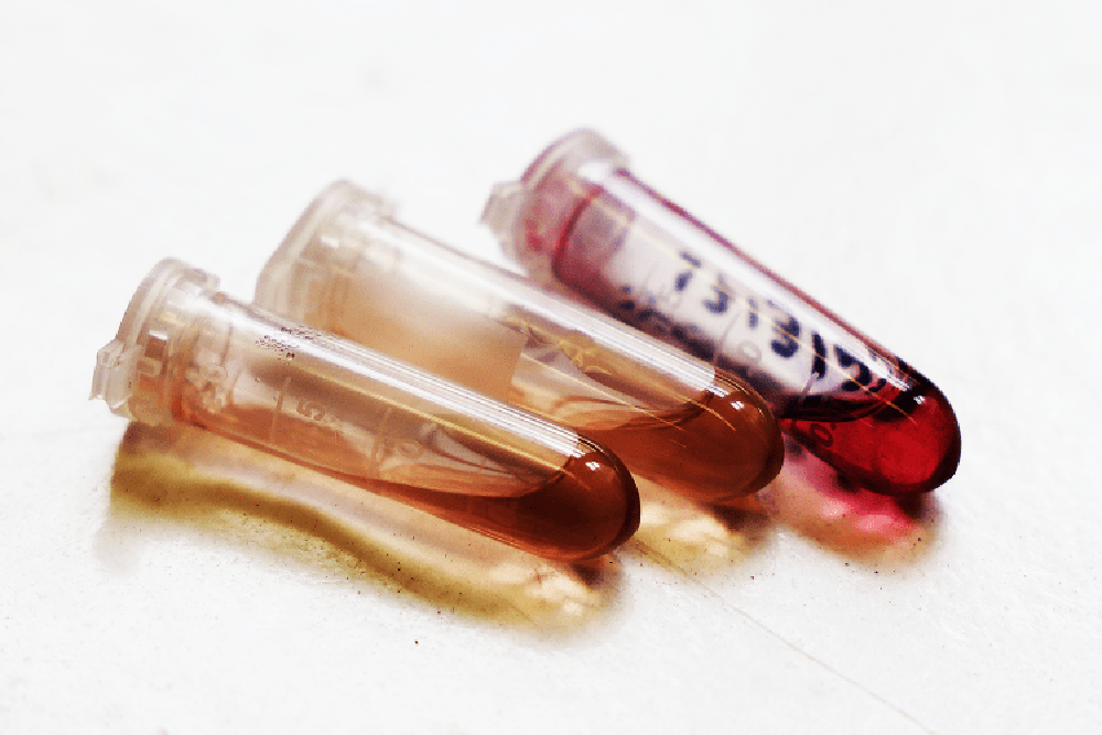 Sul Informação - Ouro à nanoescala tem potencial no tratamento do cancro
