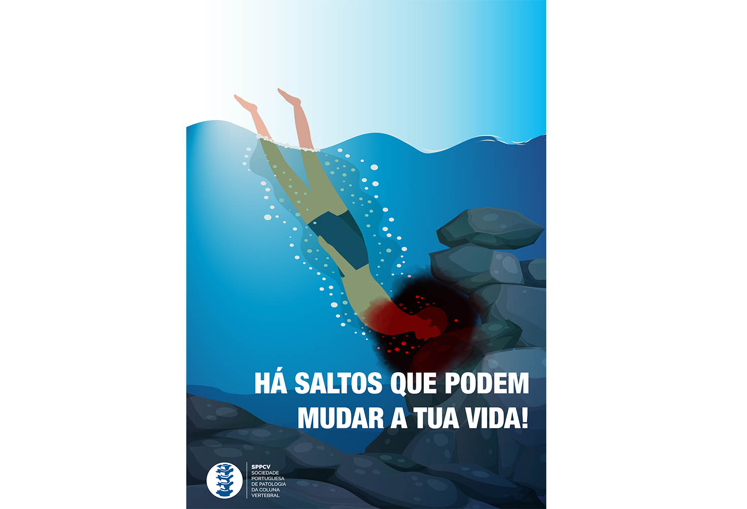 Sul Informação - Médicos querem prevenir lesões permanentes na coluna vertebral durante o Verão