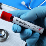 Há um surto de Hepatite A no Algarve e no Alentejo, afetando sobretudo crianças, alerta a DGS