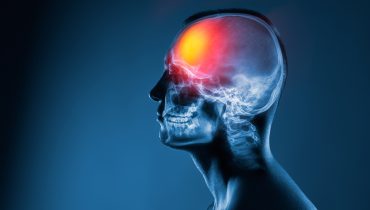 X-ray of a man's head. Medical examination of head injuries. Frontal part of the brain is highlighted by red colour.|AVC_Acidente Vascular Cerebral_Depositphotos (1)