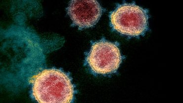 Covid19 coronavirus
