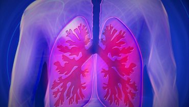 Pulmões tuberculose|tuberculose dgs algarve|tuberculose dgs alentejo|tuberculose dgs algarve 3|tuberculose dgs algarve 2