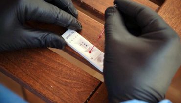 Unidade-de-Diagnostico-Testes-serologicos-e-a-Covid-19