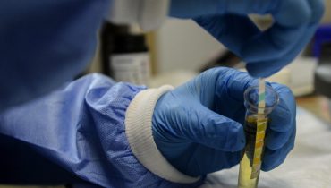 coronavirus covid19 laboratorio testes