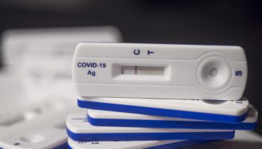 testes-covid-19-pandemia-coronavirus (2)|covid 2207|covid ativos 2207